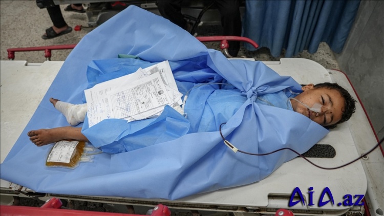 ÜST :Qəzzada 16 min 500-dən çox insanın təcili tibbi yardıma ehtiyacı var
