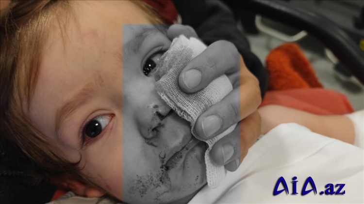 Paytaxtda iki uşağı yaralayan pitbulun sahibi həbs edilib