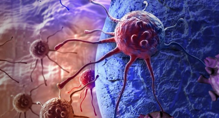 Rusiyalı alimlərdən ümidverici nəticə: Fərdiləşdirilmiş xərçəng peyvəndi klinik sınaqlarda müsbət göstəricilər nümayiş etdirib
